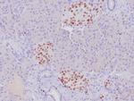 INSM1 Antibody in Immunohistochemistry (Paraffin) (IHC (P))