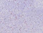 TIA-1 Antibody in Immunohistochemistry (Paraffin) (IHC (P))