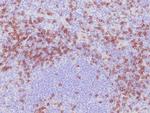 CD8 Antibody in Immunohistochemistry (Paraffin) (IHC (P))