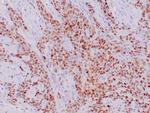 p21 Antibody in Immunohistochemistry (Paraffin) (IHC (P))