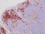 CD38 Antibody in Immunohistochemistry (Paraffin) (IHC (P))