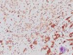 p120 Antibody in Immunohistochemistry (Paraffin) (IHC (P))