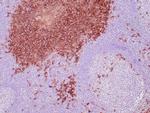 CD138 Antibody in Immunohistochemistry (Paraffin) (IHC (P))