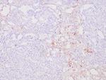 AFP Antibody in Immunohistochemistry (Paraffin) (IHC (P))