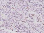 ATRX Antibody in Immunohistochemistry (Paraffin) (IHC (P))