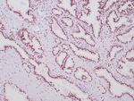 Androgen receptor Antibody in Immunohistochemistry (Paraffin) (IHC (P))