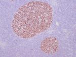 BCL-6 Antibody in Immunohistochemistry (Paraffin) (IHC (P))