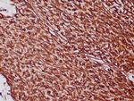 Vimentin Antibody in Immunohistochemistry (Paraffin) (IHC (P))