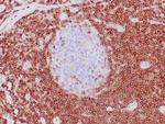 BCL-2 Antibody in Immunohistochemistry (Paraffin) (IHC (P))