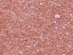 Neurofilament Antibody in Immunohistochemistry (Paraffin) (IHC (P))