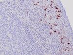 TRAcP Antibody in Immunohistochemistry (Paraffin) (IHC (P))
