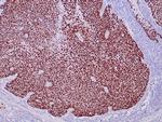 P40 Antibody in Immunohistochemistry (Paraffin) (IHC (P))
