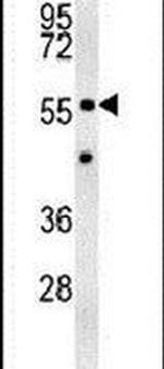 ZNF385B Antibody in Western Blot (WB)