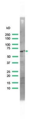Zap-70 Antibody in Western Blot (WB)