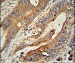 ZBBX Antibody in Immunohistochemistry (IHC)