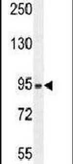 ZBBX Antibody in Western Blot (WB)
