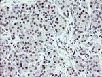 ZBED1 Antibody in Immunohistochemistry (Paraffin) (IHC (P))