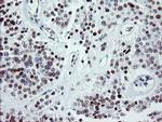 ZBED1 Antibody in Immunohistochemistry (Paraffin) (IHC (P))