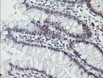 ZBED1 Antibody in Immunohistochemistry (Paraffin) (IHC (P))