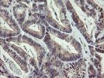 ZBED1 Antibody in Immunohistochemistry (Paraffin) (IHC (P))