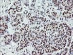 ZBED1 Antibody in Immunohistochemistry (Paraffin) (IHC (P))