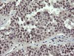 ZBED1 Antibody in Immunohistochemistry (Paraffin) (IHC (P))