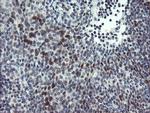 ZBED1 Antibody in Immunohistochemistry (Paraffin) (IHC (P))