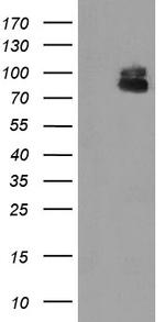 ZBED1 Antibody in Western Blot (WB)
