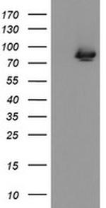 ZBED1 Antibody in Western Blot (WB)
