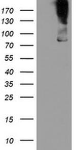 ZBED1 Antibody in Western Blot (WB)