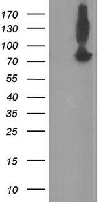 ZBED1 Antibody in Western Blot (WB)