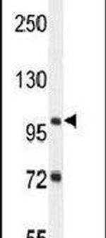 ZBTB10 Antibody in Western Blot (WB)