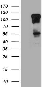 ZBTB17 Antibody in Western Blot (WB)