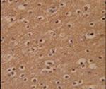ZBTB2 Antibody in Immunohistochemistry (IHC)