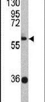 ZBTB2 Antibody in Western Blot (WB)
