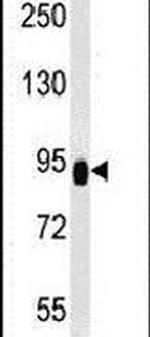 ZBTB41 Antibody in Western Blot (WB)