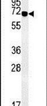 ZBTB5 Antibody in Western Blot (WB)