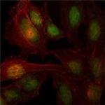 ThPOK Monoclonal Antibody (7C12)