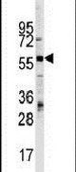 ThPOK Antibody in Western Blot (WB)