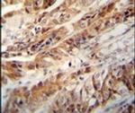 ZC3H15 Antibody in Immunohistochemistry (IHC)