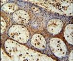ZC3H3 Antibody in Immunohistochemistry (IHC)