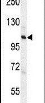 ZC3H3 Antibody in Western Blot (WB)