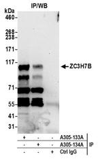 ZC3H7B Antibody in Immunoprecipitation (IP)