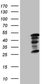 ZC3H8 Antibody in Western Blot (WB)