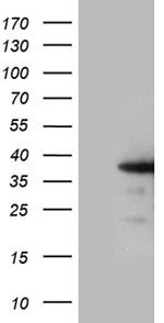 ZCCHC17 Antibody in Western Blot (WB)