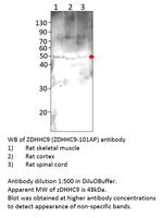 ZDHHC9 Polyclonal Antibody