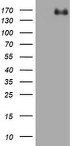 ZEB1 Antibody in Western Blot (WB)