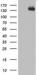 ZEB1 Antibody in Western Blot (WB)