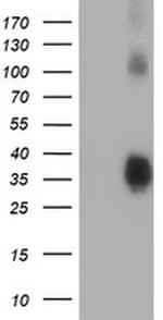 ZFP36 Antibody in Western Blot (WB)