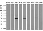 ZFP36 Antibody in Western Blot (WB)